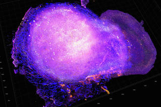 transparent tumor tomography of a breast cancer cell