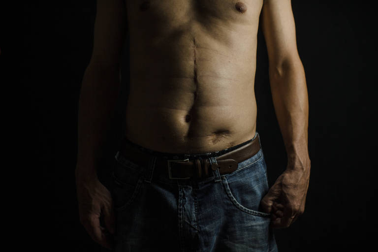 Eduardo foi baleado seis vezes durante os ataques do PCC e até hoje sofre com sequelas causadas pelos ferimentos