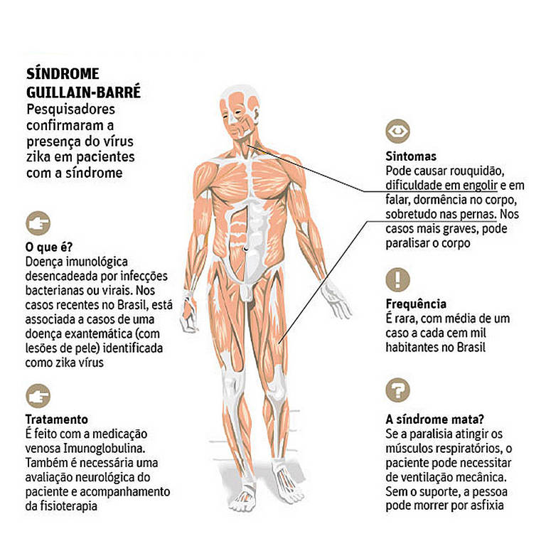 Segundo a OMS, a síndrome de Guillain-Barré aumentou em cinco países latinos após uma epidemia do vírus da zika