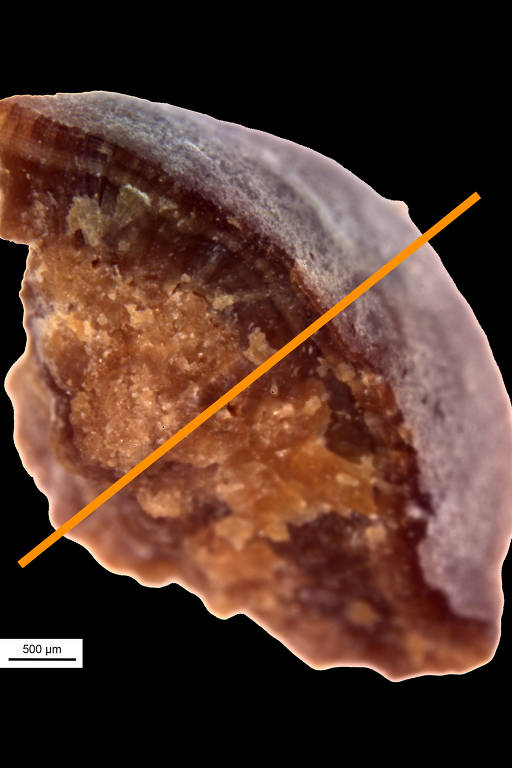 A human kidney stone fragment.
