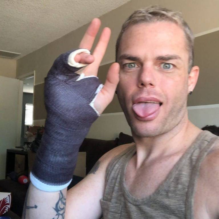 Morgan McMichaels quebra a mão após brigar com nazista