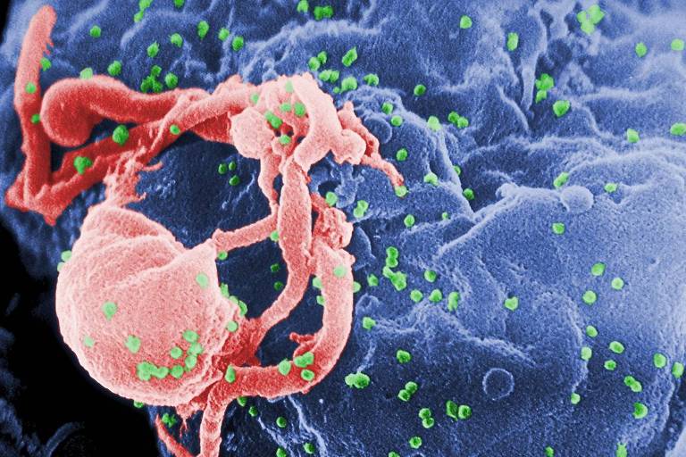 HIV (em verde) invadindo célula: