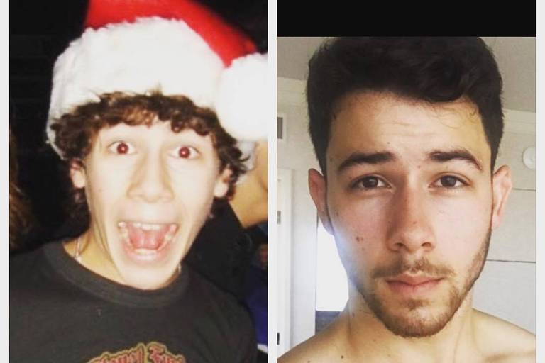O antes e depois do cantor Nick Jonas, que foi diagnosticado com diabetes na adolescência