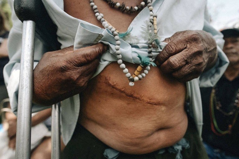 Durante visita à comunidade, indígenas relatam a e exibem marcas de violência pelo corpo para a Comissão Interamericana de Direitos Humanos no Brasil