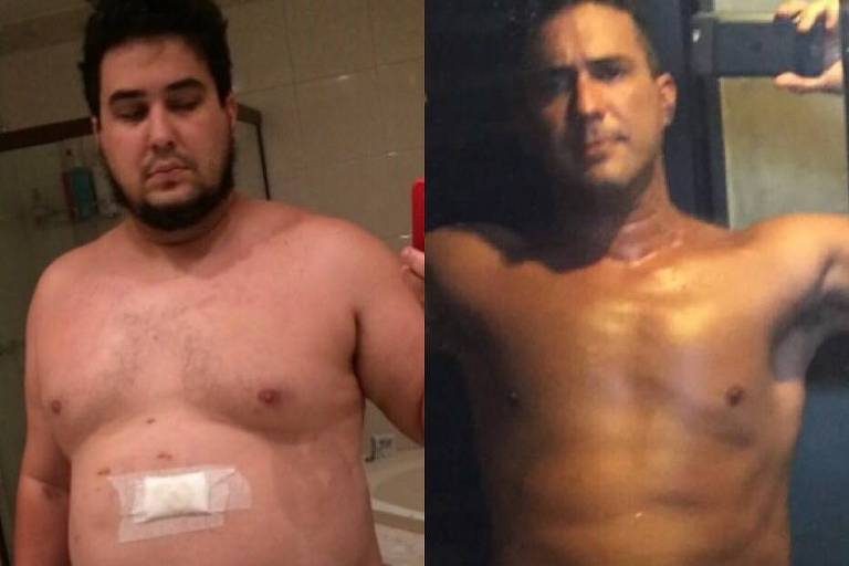 Ator e apresentador André Marques posta antes e depois de cirurgia feita há cinco anos
