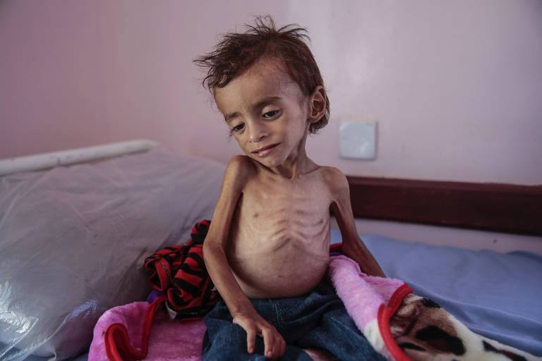 Número de crianças mortas por fome no Iêmen pode chegar a 85 mil