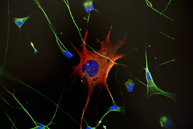 Células cancerígenas com diferentes cores, como vermelho, azul e verde