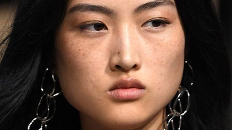 Propaganda da Zara gera polêmica na China: afinal, sardas são sinal de feiura para asiáticos?