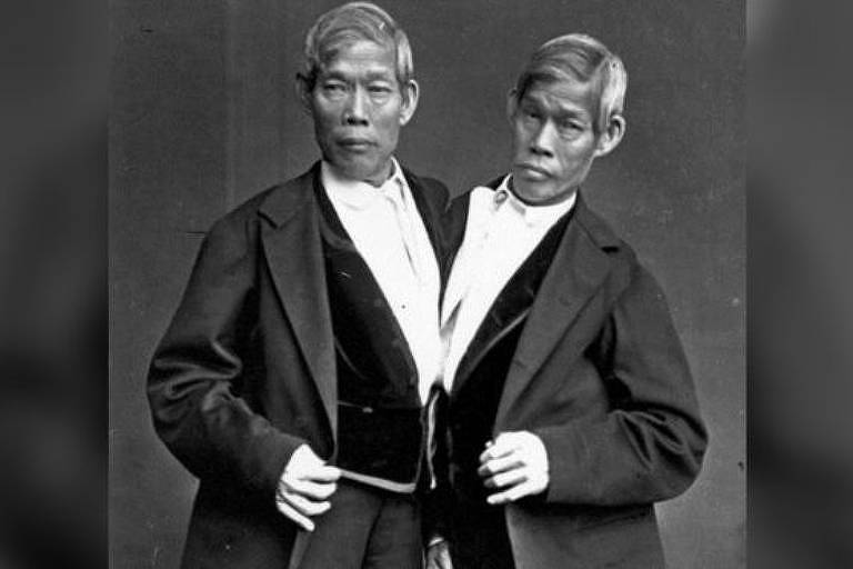 Chang e Eng Bunker, os primeiros irmãos chamados siameses