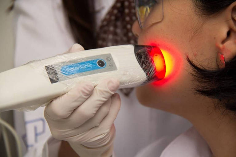 Centro de Pesquisa em Óptica e Fotônica desenvolve dispositivo para tratamento não invasivo do câncer não melanoma, o mais frequente no Brasil e no mundo