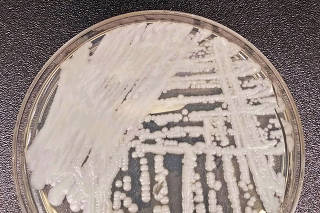 Cultured Candida auris in a petri dish.