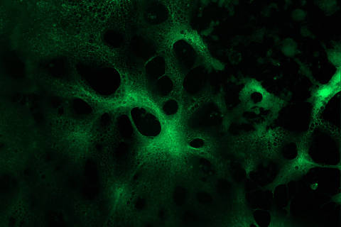 Vírus da herpes do tipo 1 brilha em verde fluorescente após ser incubado em restos celulares presentes em soro sanguíneo humano	