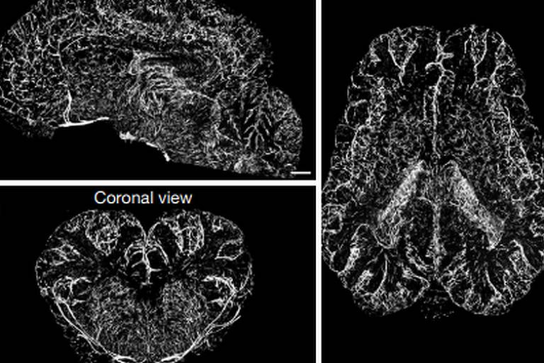 Tomografias de cérebros de porcos irrigados com a substância desenvolvida pelos cientistas
