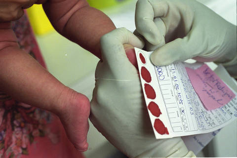 SÃO PAULO, SP, BRASIL, 00-01-2002: Bebê faz exame do pezinho na APAE, em São Paulo (SP). O teste previne o retardo mental pois detecta as principais causas de doenças. (Foto: Gustavo Roth/Folhapress - Negativo 00305-02)