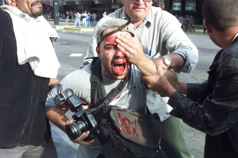 O repórter fotográfico Alex Silveira grita após ser  atingido por uma bala de borracha em protesto de funcionários públicos em São Paulo