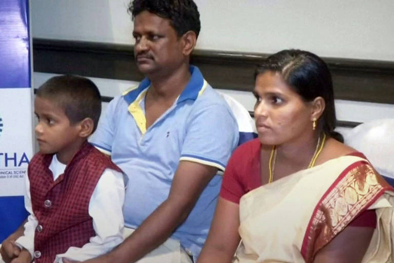 Ravindran, de 7 anos, teve mais de 500 dentes retirados da boca na Índia