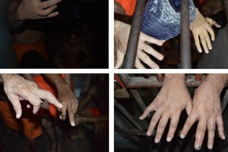 Mãos de diferentes presos com indícios de traumatismo nos dedos referentes a tortura, segundo relatório 