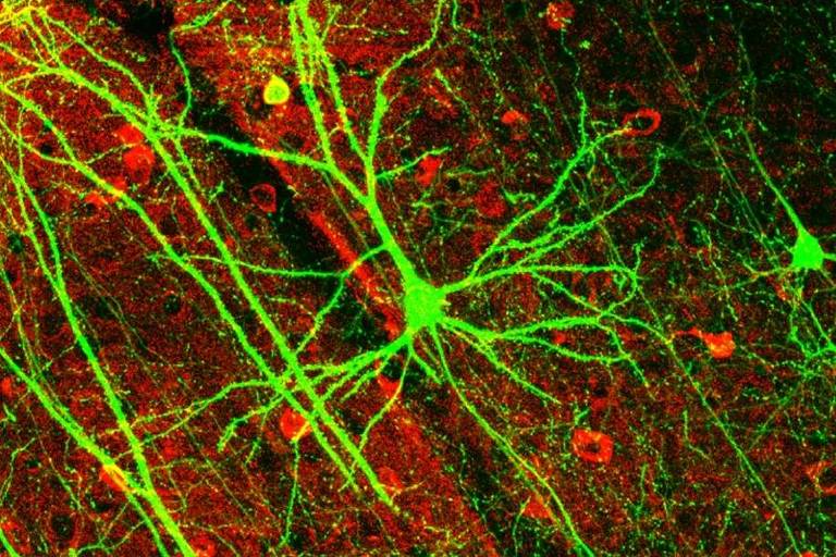 Imagem de um neurônio com coloração por meio da técnica de fluorescência