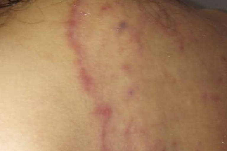 Lesões em vítimas de maus tratos na clínica em imagens que fazem parte do inquérito da polícia