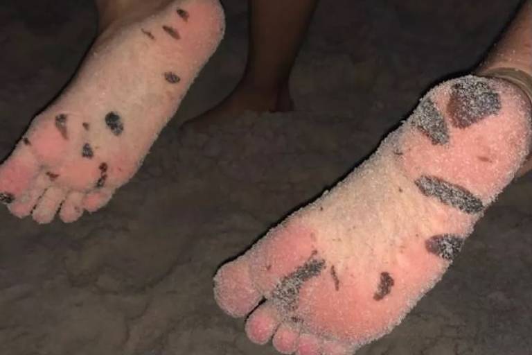 Whindersson Nunes posta foto de fã com os pés sujos de óleo em praia de Alagoas