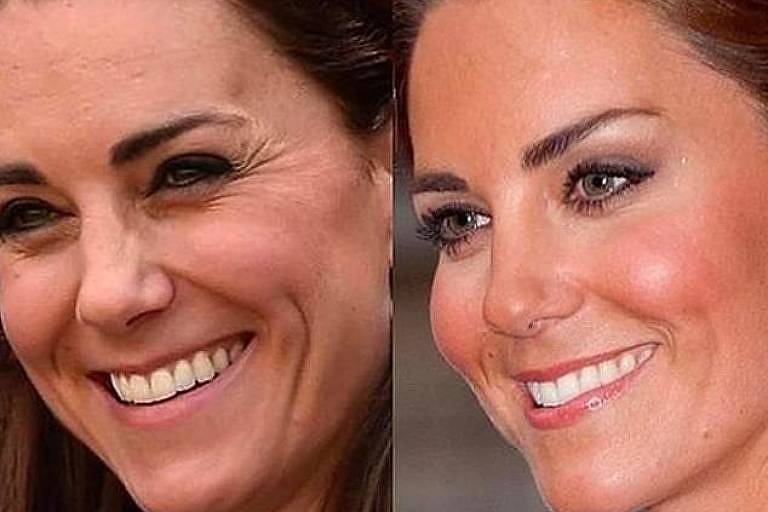Kate Middleton tem imagens usadas em anúncio de clínica de estética 