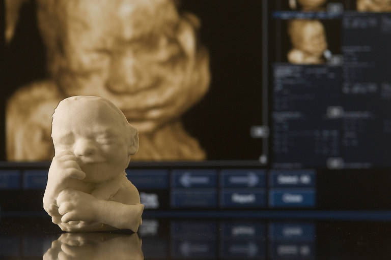 impressao 3D de um feto