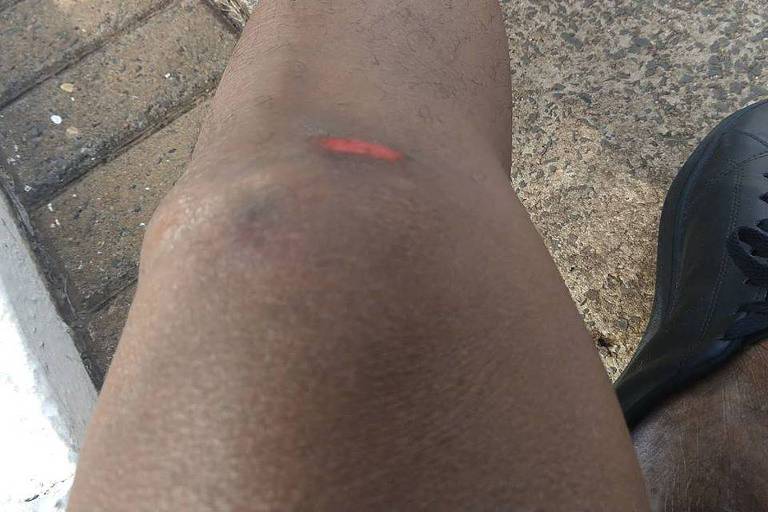 Docente mostra ferimento que sofreu em briga nesta quarta-feira (20) em Bauru