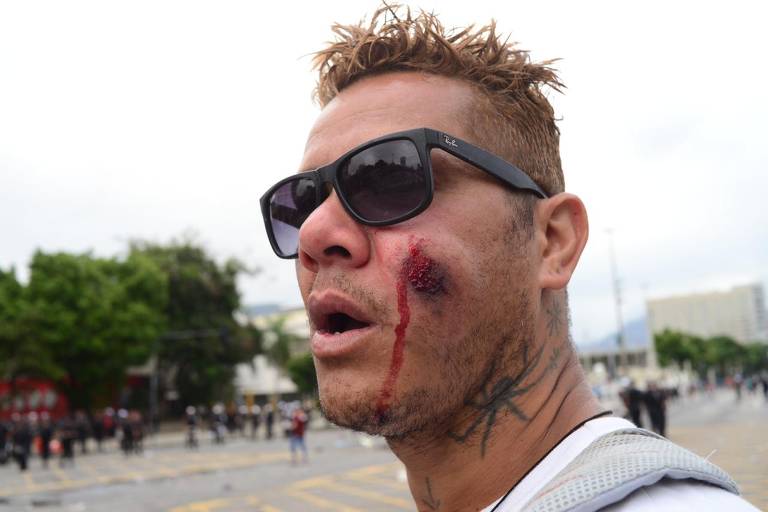 Homem que acompanhou o desfile de jogadores do Flamengo anda pela rua com o rosto ensanguentado