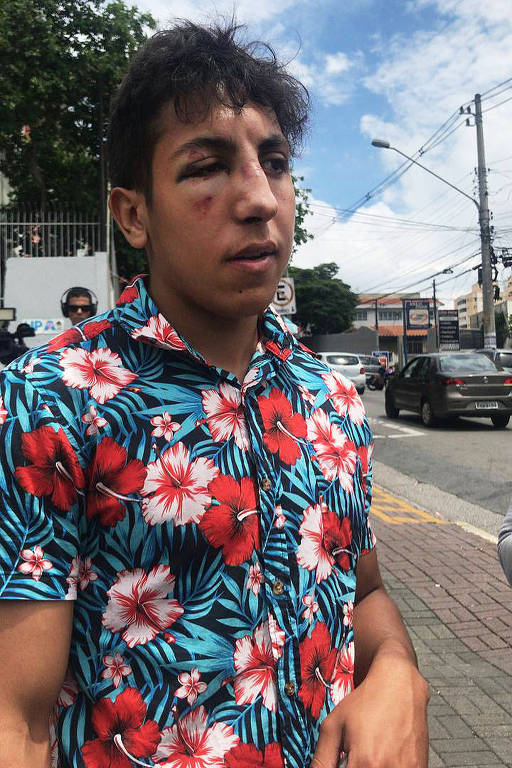 O jovem Vinícius Silveira Martins,18, ferido na confusão durante baile Funk em Paraisópolis, zona sul de São Paulo