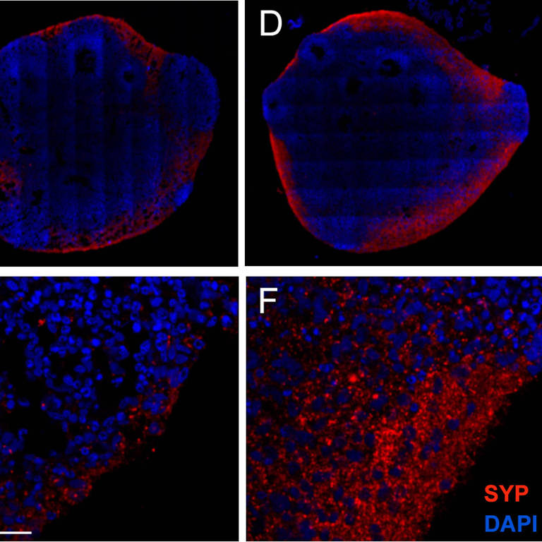 Minicérebros corados em vermelho demarcam a presença de proteína (SYP) importante na formação de sinapses