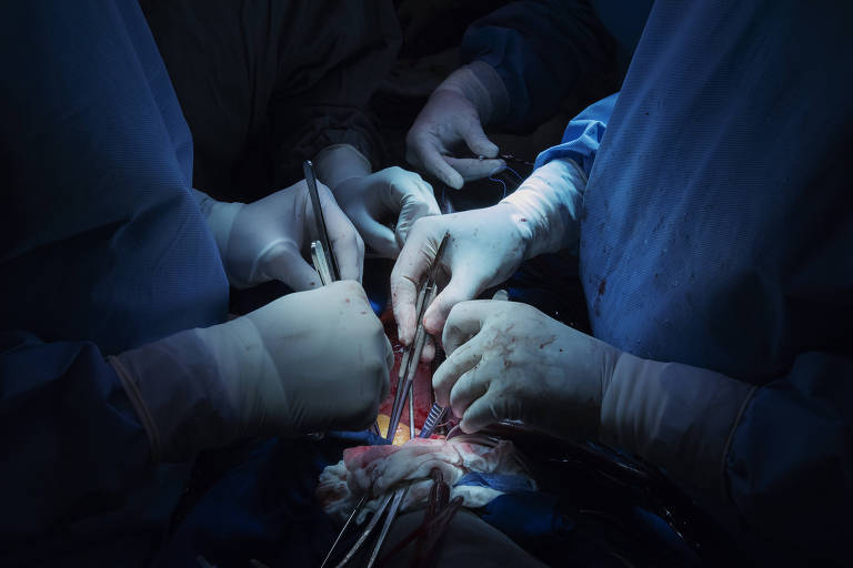 Três pares de mãos trabalham com utensílios cirúrgicos sobre o peito de uma pessoa; não é possível ver dentro, apenas as mãos, de luvas