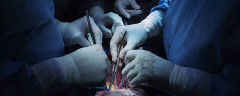 So Paulo, SP. 20/05/2018. Cirurgies transplantam corao doado em uma paciente no centro cirrgico do Instituto do Corao ( INCOR ) em So Paulo. ( Foto: Lalo de Almeida/ Folhapress ) CIæNCIA  *** EXCLUSIVO FOLHA***
