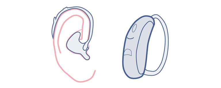 Demência: uso de aparelho auditivo reduz risco da doença em idosos, diz  estudo; entenda