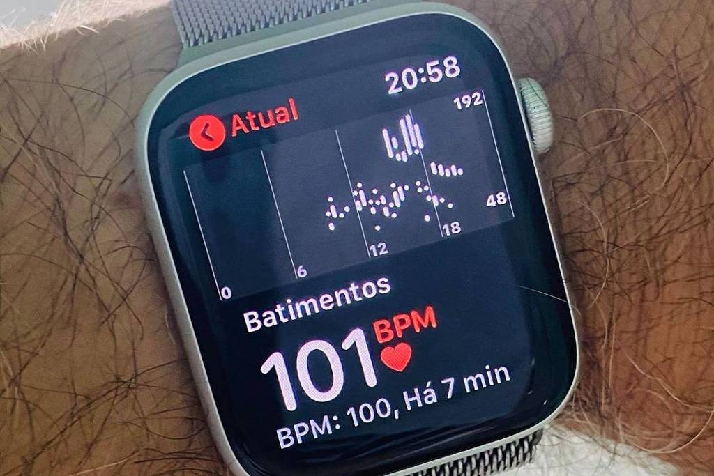 Smartwatches são eficazes no diagnóstico de arritmias cardíacas