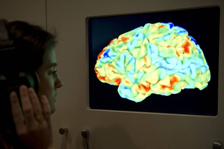 Mulher olha para ressonância magnética de cérebro 
