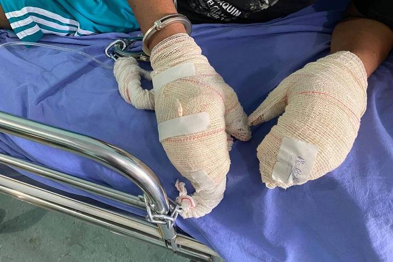 OAB denuncia surto de bactéria que provoca feridas e corrosão na pele de presos em Roraima
