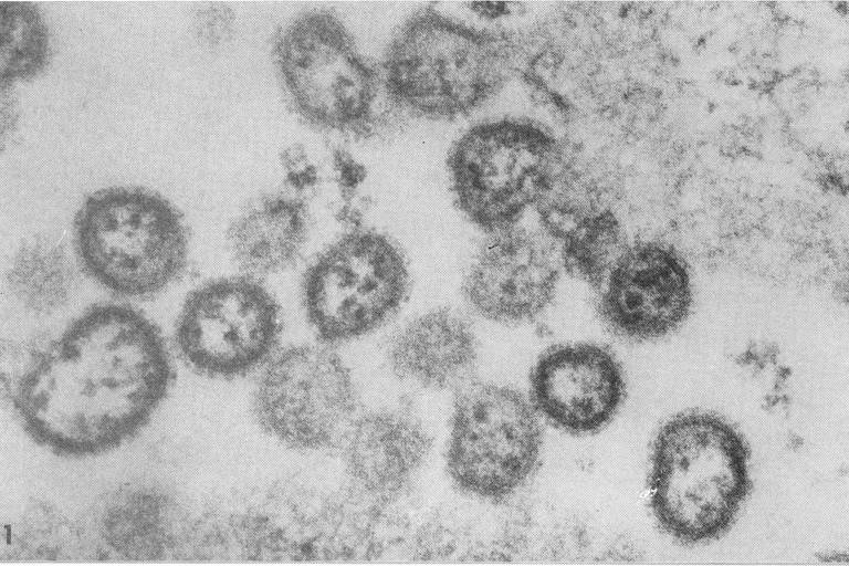 Arenavírus detectado em Serra Leoa
