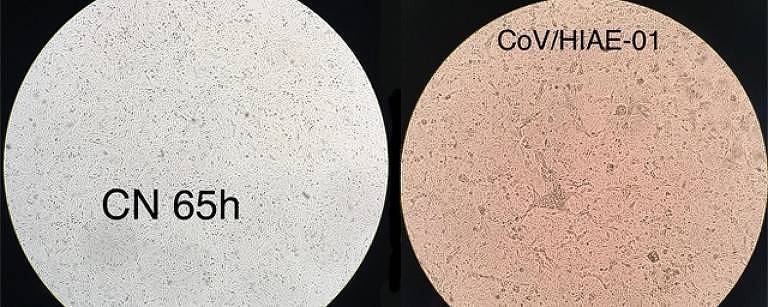À esquerda uma célula humana não infectada; à direita, o coronavírus multiplicando-se em célula cultivada em laboratório