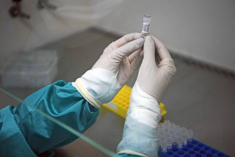 An analyst at Fiocruz laboratory, a public health research institute, in Rio de Janeiro holds a sample of mucus to be tested for COVID-19, on March 11, 2020. - The World Health Organisation (WHO) declared the Coronavirus a pandemic with 118,000 cases in about 120  countries, and 4000 deaths. (Photo by CARL DE SOUZA / AFP) ORG XMIT: 026