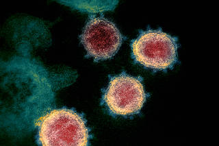 Transmission electron microscope image shows SARS-CoV-2, also known as novel coronavirus