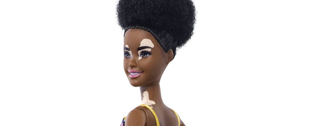 Barbie lança novas bonecas inclusivas com vitiligo e até careca