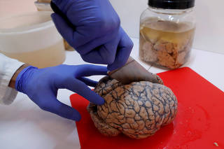 Belgian researcher Schuermans cuts a human brain, part of a collection of more than 3,000 brains that could provide insight into psychiatric diseases, at the psychiatric hospital in Duffel