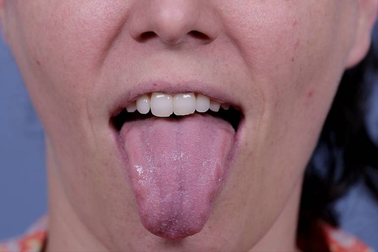 boca para o especial 'o tamanho da língua'