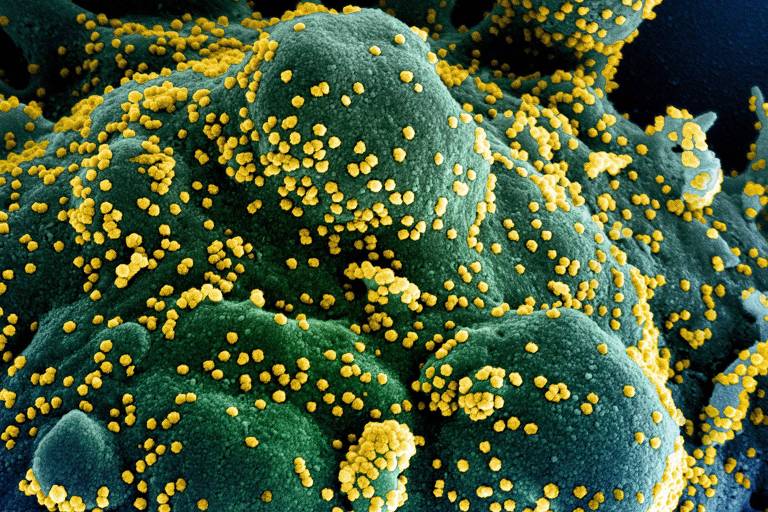 Célula humana infectada com coronavírus (pontos amarelos), em imagem colorizada artificialmente