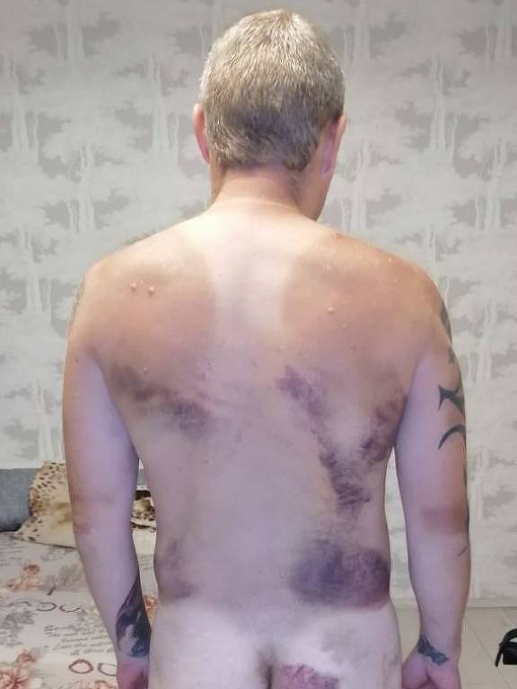 O jardineiro Sacha, 34, que foi espancado e torturado após ser detido pela polícia da Belarus