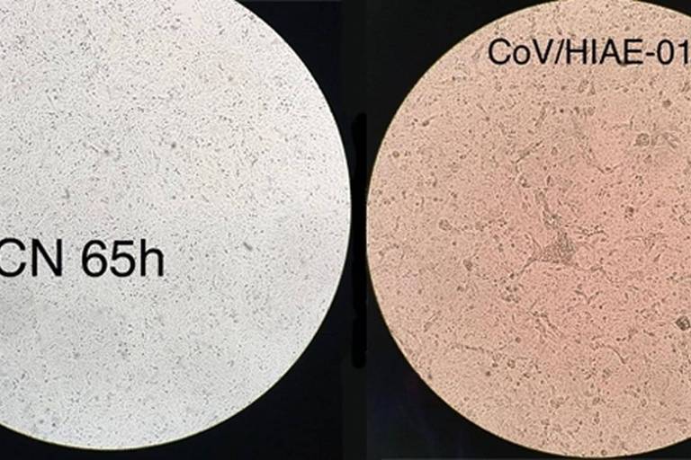Células infectadas por coronavírus