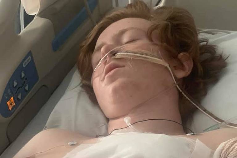 menino ruivo deitado sobre maca, inconsciente, tem um tubo de oxigenio preso ao seu nariz e vários curativos sobre seu torso e abdome