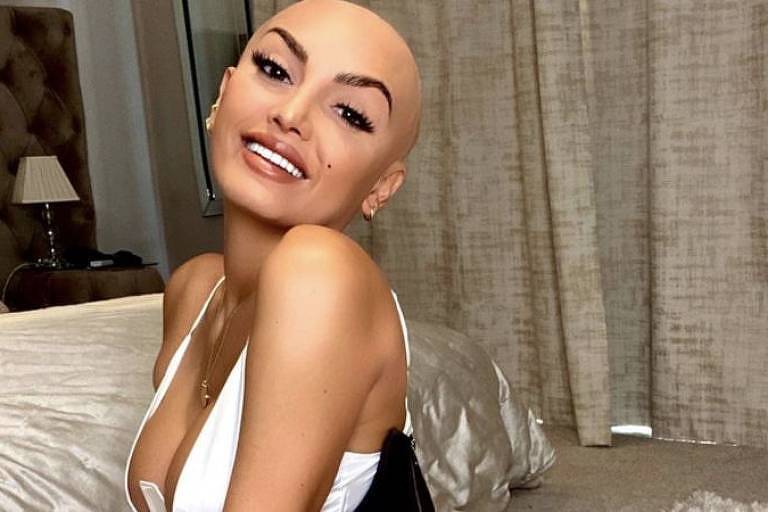 'Mostrar minha careca nas redes é libertador', diz influenciadora com alopecia