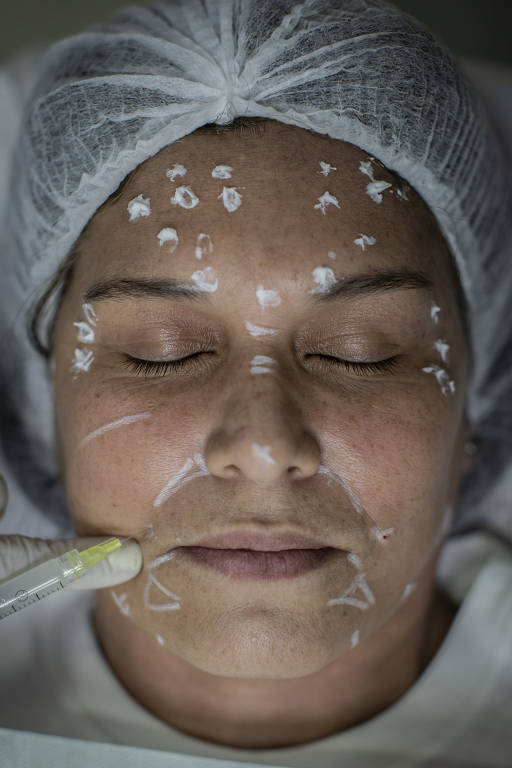 Daniela Raddi durante processo de harmonização facial