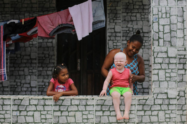 Albinos da Ilha de Maré, na Bahia, enfrentam isolamento e lutam por atenção à saúde